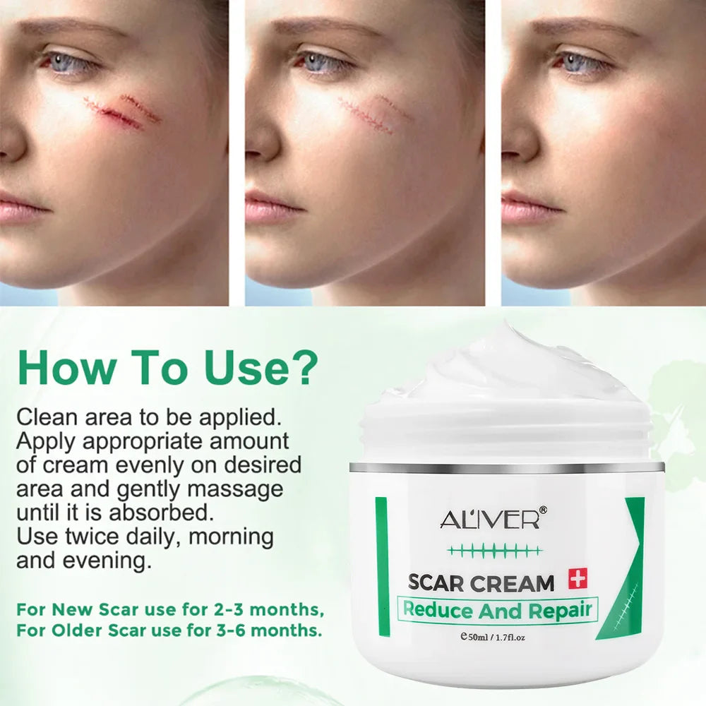 ALVER Skin Repair Cream – Acne Marks, Dark Spots & Scars 50ml