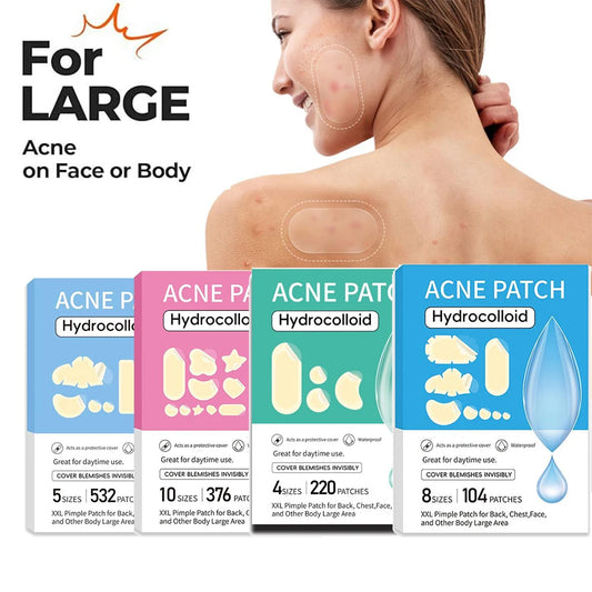 Hydrocolloid Pimple Patches – 5 Sizes, Bulk Pack Skin Care Peaceful Pleasures Health and Wellness