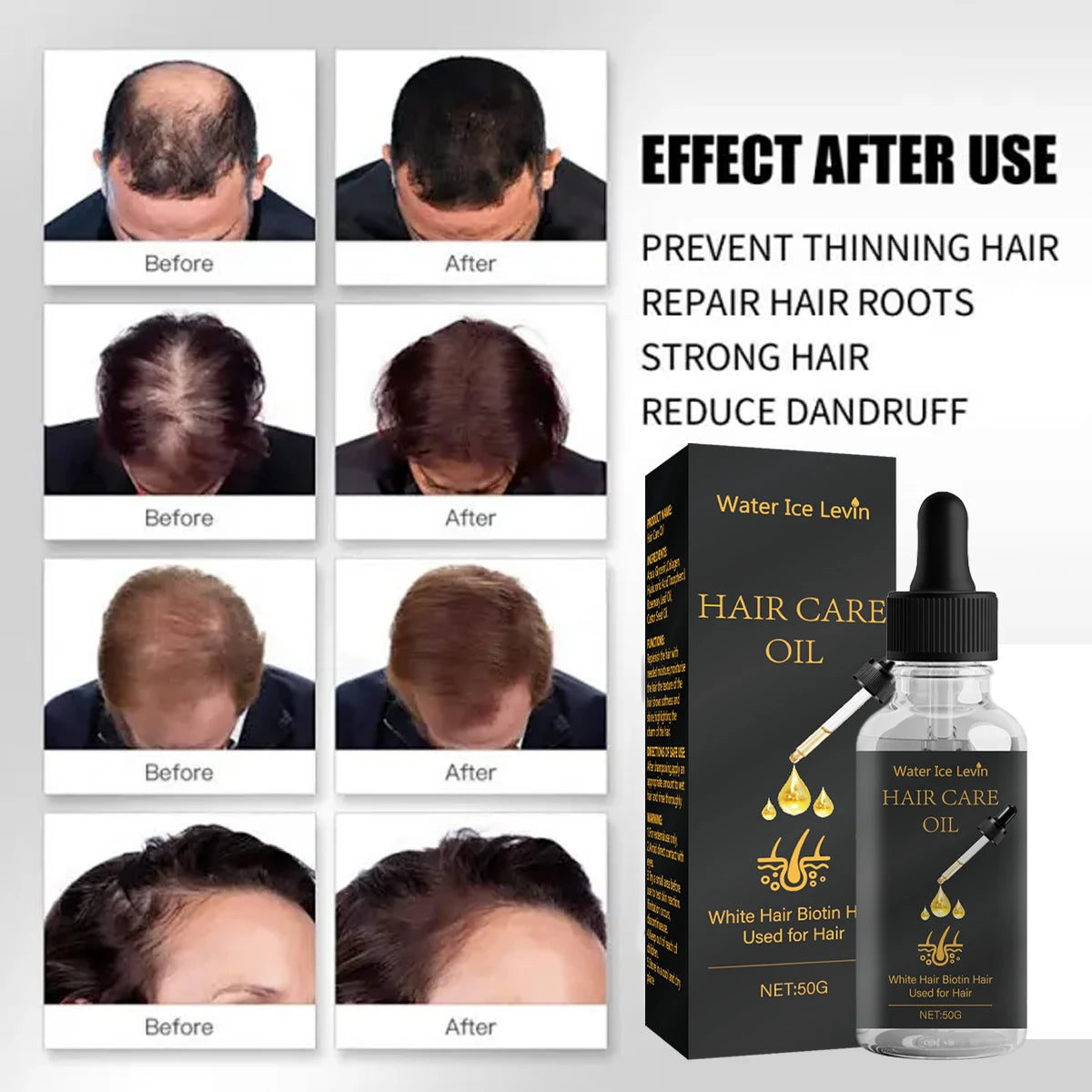 Biotin Hair Oil with Rosemary, Castor Oil & Collagen Hair Growth Oil Peaceful Pleasures Health and Wellness