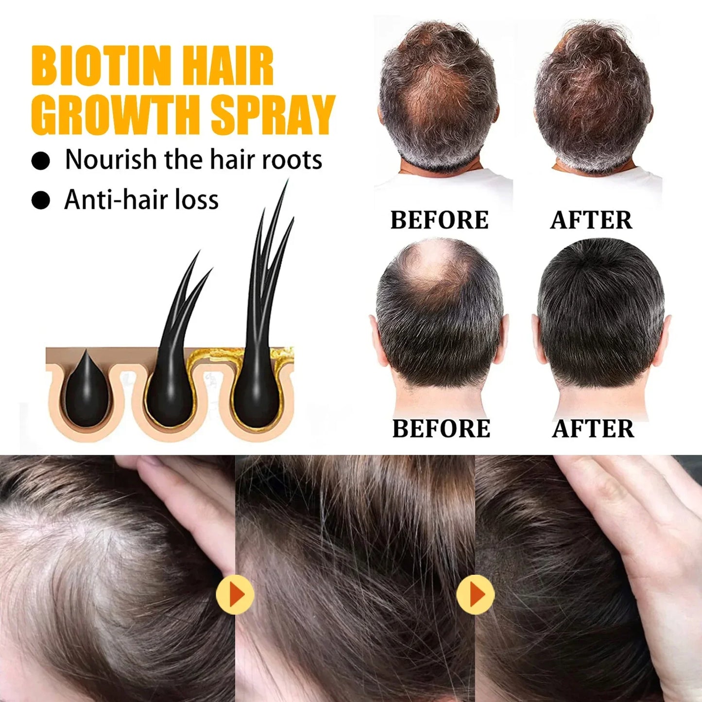 EELHOE Biotin Hair Spray For Man Women 30ml Hair Growth Repair Damage Restore Oil Scalp Repair Serum Spray Thicken Hair Care Peaceful Pleasures Health and Wellness