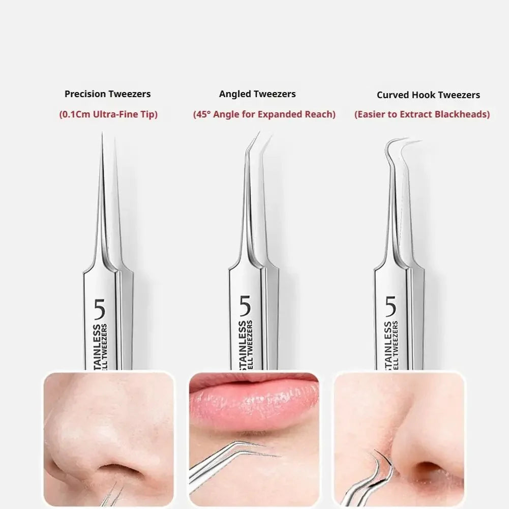 Professional Facial Blackhead Remover Tweezers,3Pcs Precision Pimple Popper Tool Kit for Whitehead Ance Blemishs Comedones Peaceful Pleasures Health and Wellness