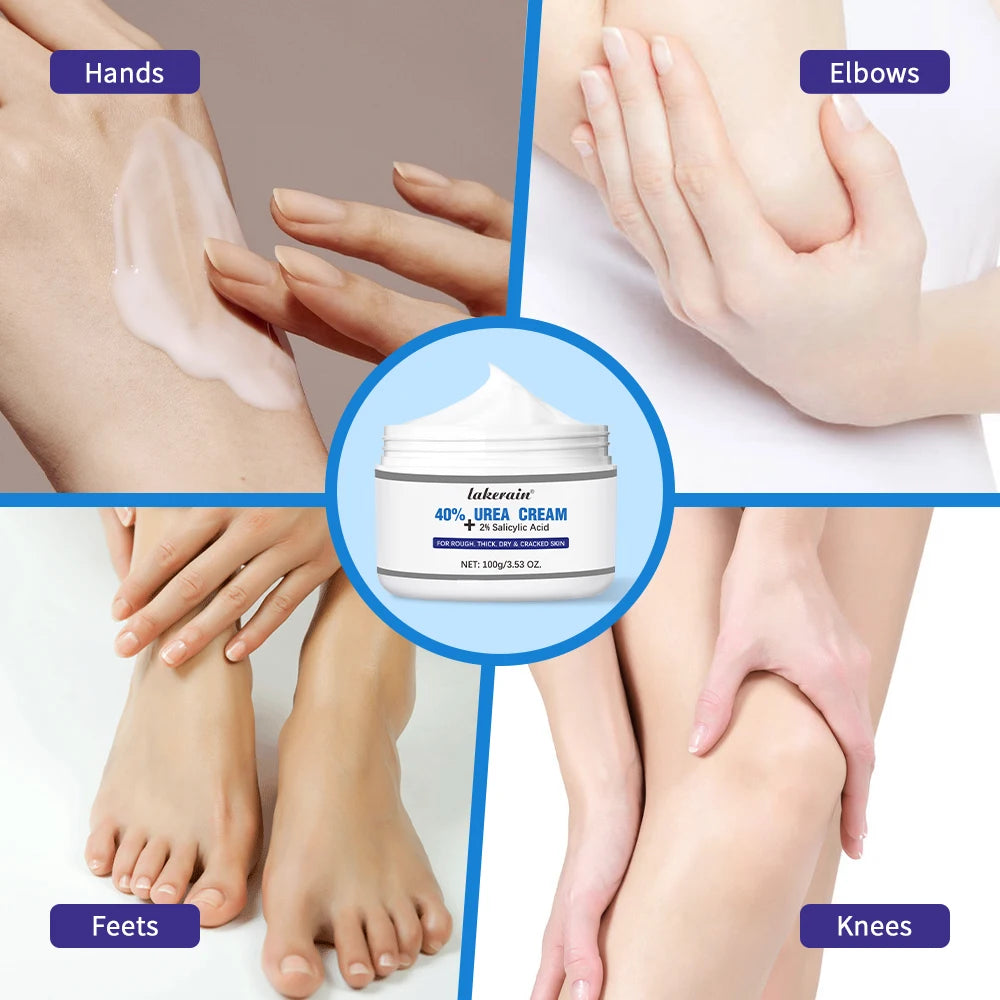 New 42% Urea Cream + 2% Salicylic acid Foot and hand Moisturizer, deep moisturizer and Nourishing moisturizer Peaceful Pleasures Health and Wellness
