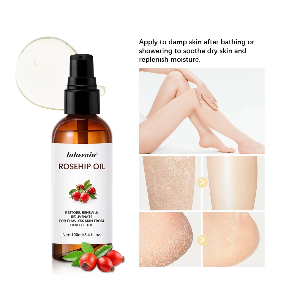 Organic Rosehip Oil 30ml – Anti-Aging Scar & Face Moisturizer Rosehip Face Oil Peaceful Pleasures Health and Wellness
