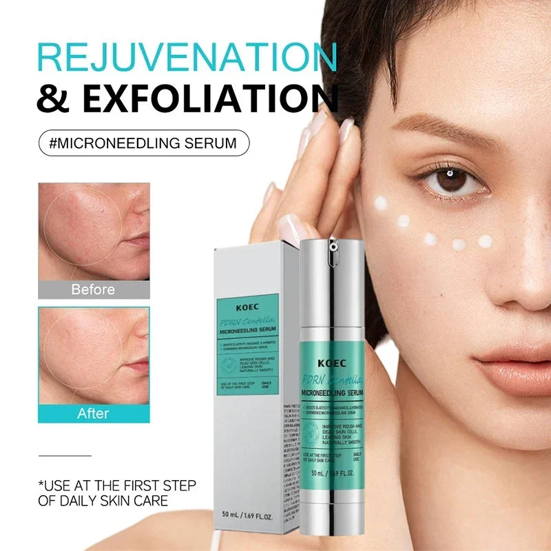 Centella Asiatica Microneedle Serum – Hydrate, Firm & Brighten
