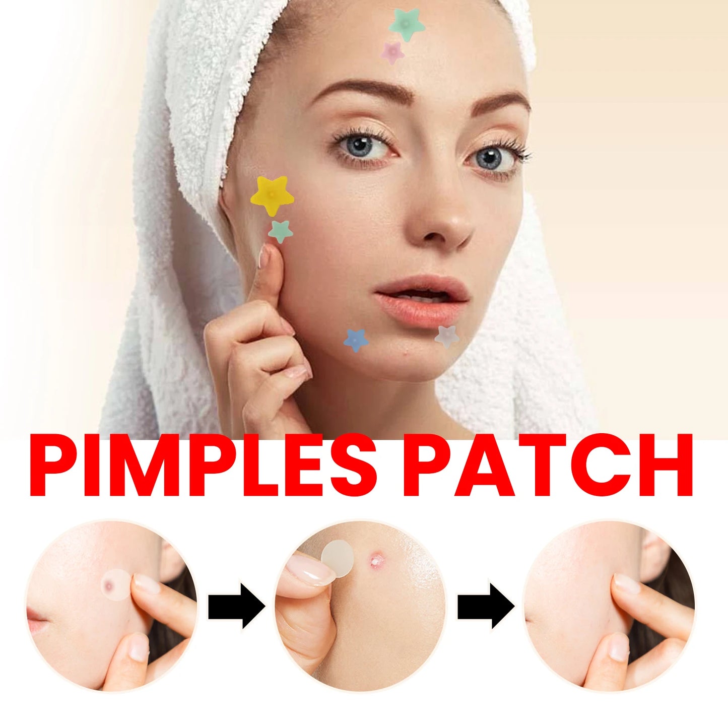 200-Pc Star Hydrocolloid Acne Pimple Patches – Fade Blemishes