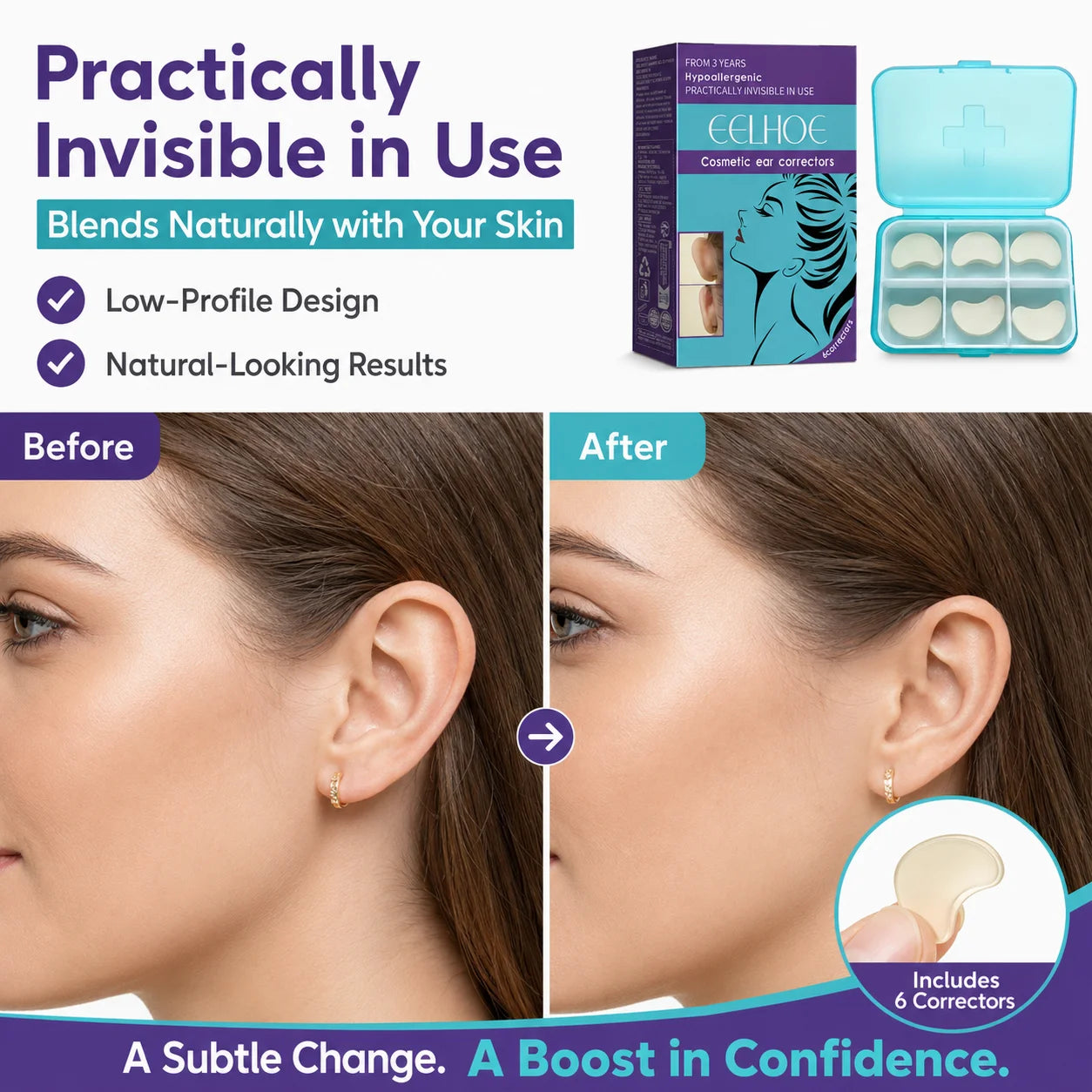 Waterproof Ear Shaping Stickers | Auricle Support Tape