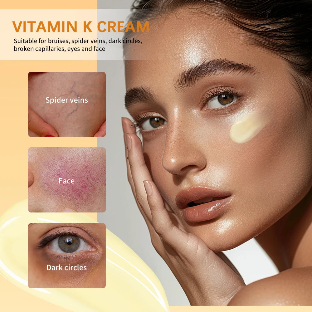 Vitamin K Cream Anti-aging And Wrinkle Removal Varicose Vein Relief Cream Massage Care Relieve Leg Soreness Swelling Ointment Peaceful Pleasures Health and Wellness