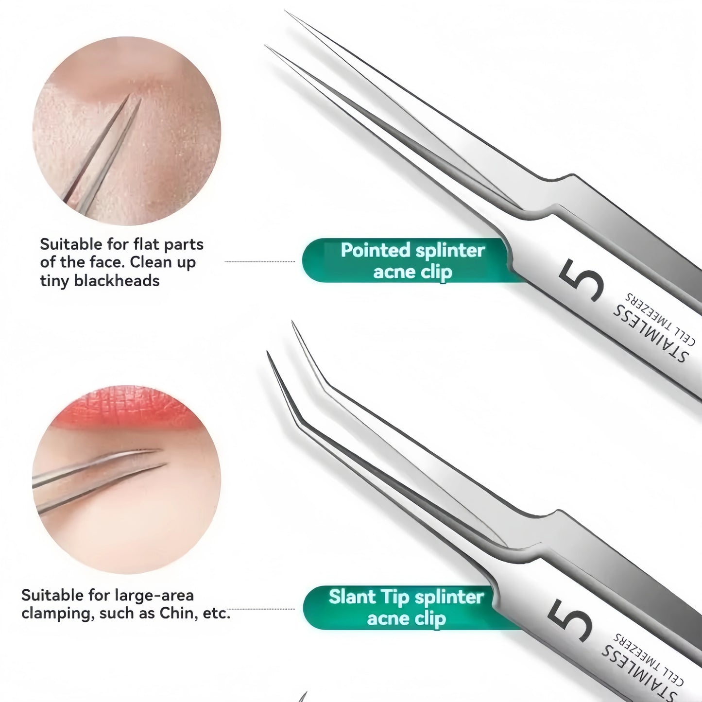 8-Piece Stainless Steel Blackhead Extraction Tool Kit