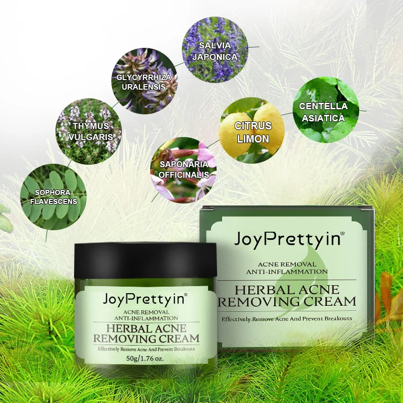 JoyPretty Herbal Acne Face Cream – Oil Control & Marks Removal
