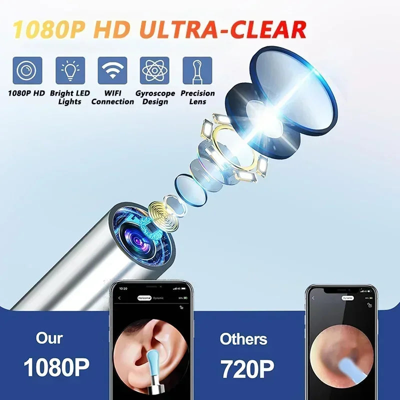 Visual Ear Wax Cleaner with Camera Safe Earwax Removal Endoscope with 5M Camera Luminous Otoscope Ear Cleaning Tools Ear Care Peaceful Pleasures Health and Wellness
