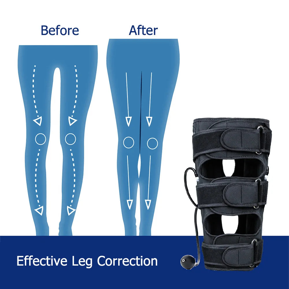 O X Legs Orthotic Corrector for Adults Leg Straightening Correction Physical Traction Leg Straightening Beauty Legs Shape Brace Peaceful Pleasures Health and Wellness