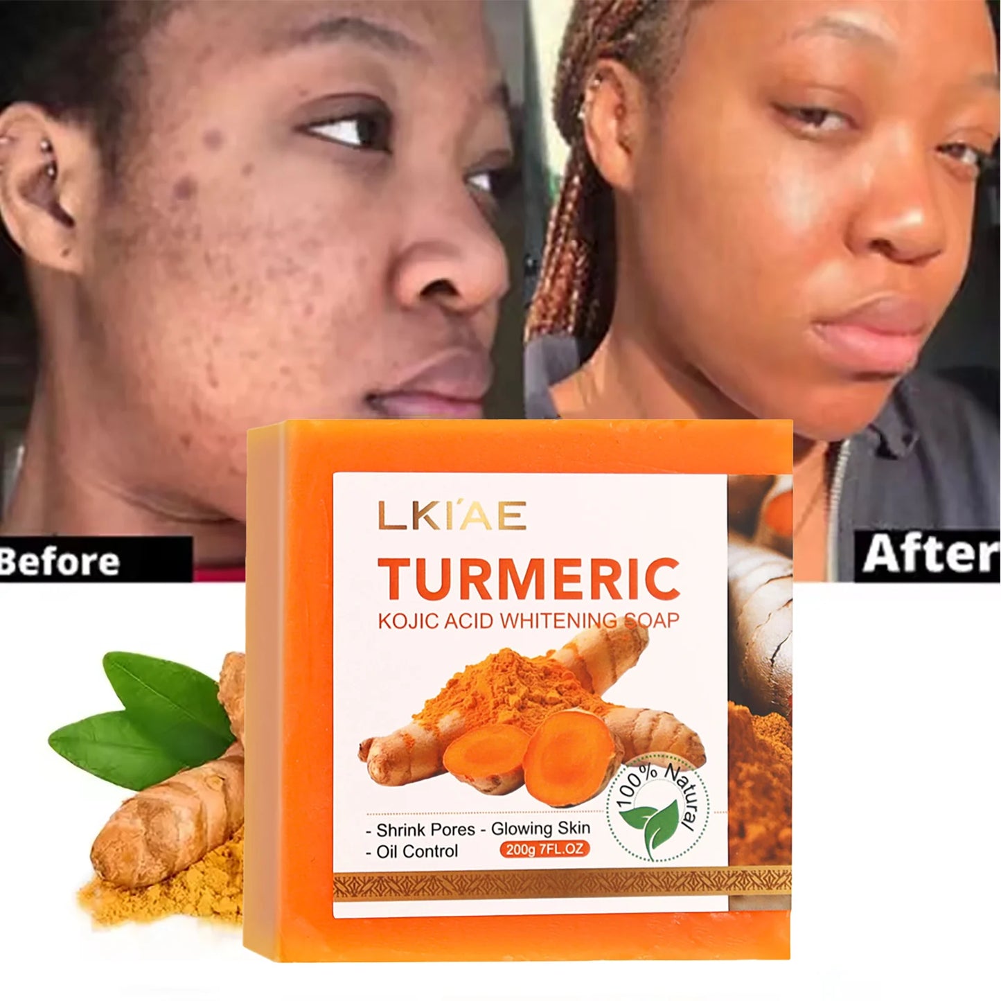 AILKE Turmeric Kojic Acid Brightening Soap Bar – Face & Body