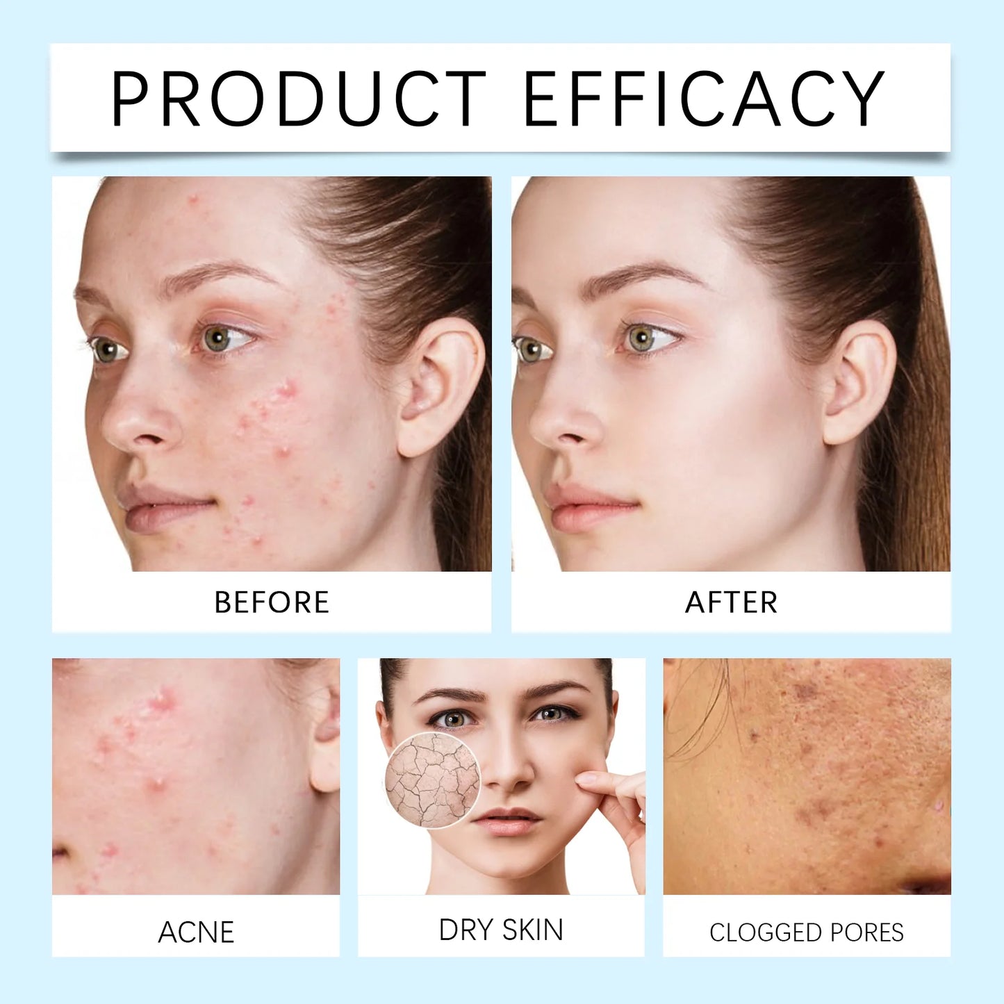120-Count Salicylic Acid Acne Patches | Invisible Blemish Dots