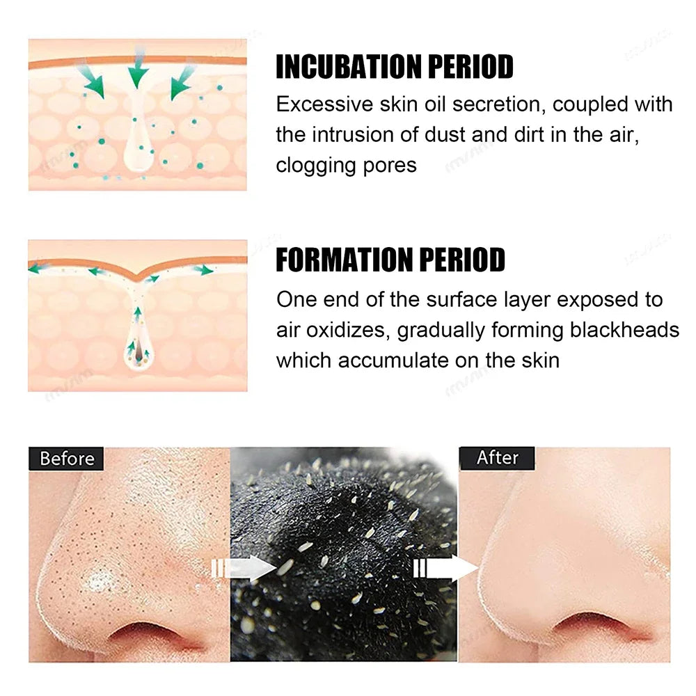 10-50pcs Nose Strips For Blackheads Acne Removal Instant Pore Unclogging Mask Deep Cleansing Nose Clean Patch Beauty Skin Care Peaceful Pleasures Health and Wellness