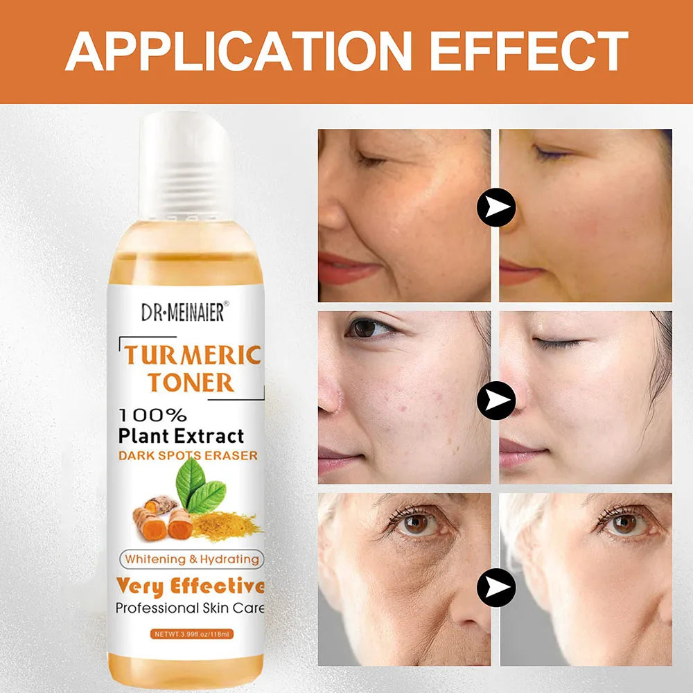 2pcs Tumeric Dark Spots Toner Spots Eraser Corrector Turmeric Fade Blemishes Dark Spot Remover Acne Remover Toner for Dark Skin Peaceful Pleasures Health and Wellness