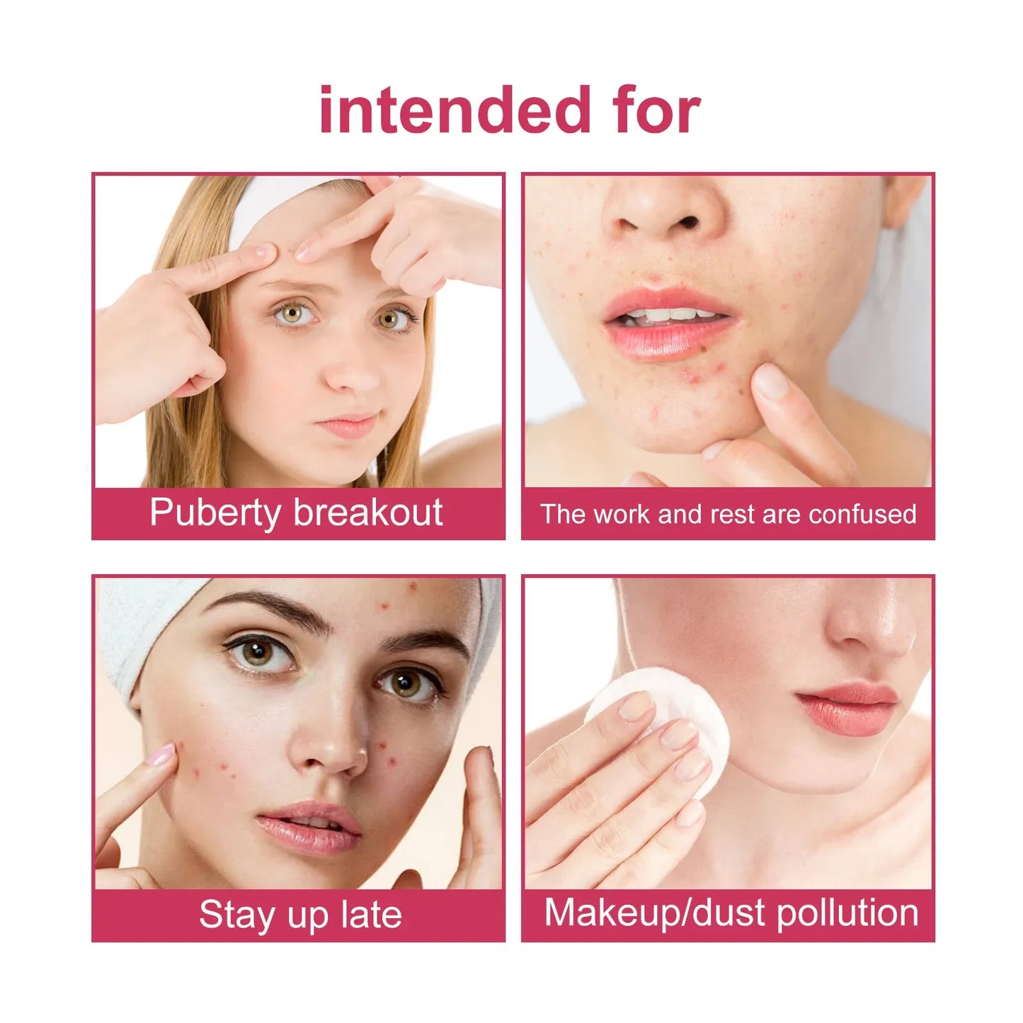 Wiieey Star Acne Patches – Colorful Pimple Stickers 144–288pc