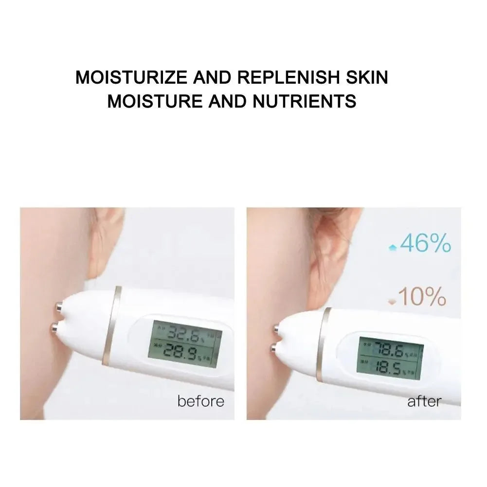 Soluble Face Lifting Threads Serum for Anti-Aging Peaceful Pleasures Health and Wellness