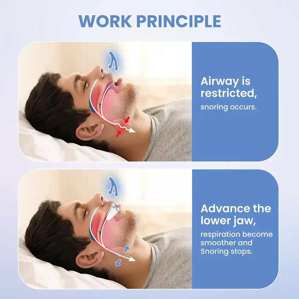 Reusable Anti-Snoring Silicone Mouthpiece | Quiet Sleep Aid Anti-Snoring Mouthpiece Peaceful Pleasures Health and Wellness