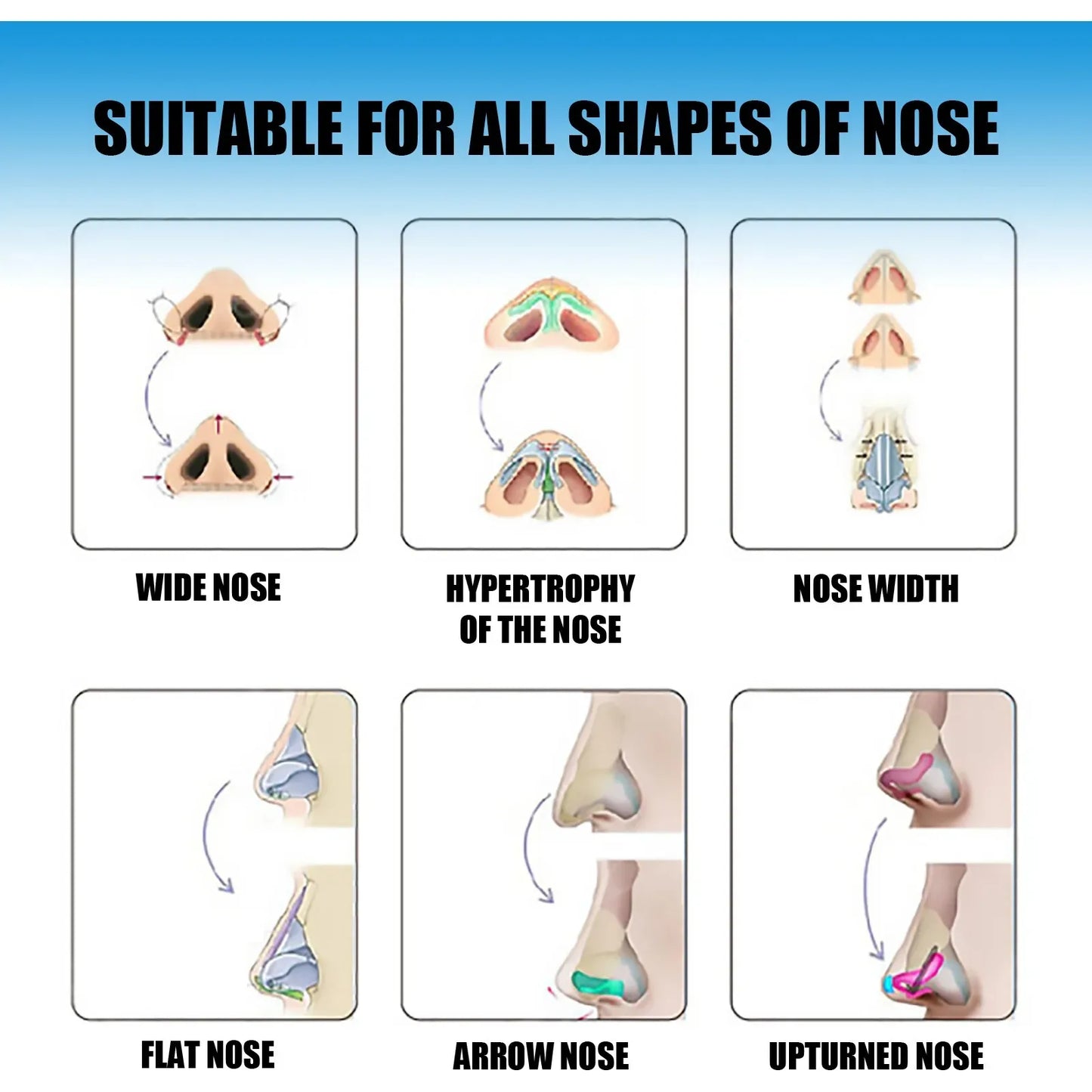 Nose Lifting Essential Oil Lift Up Heighten Rhinoplasty Care Beauty Nose Beautiful Shaping Nosal Bone Remodeling Massage Essence Peaceful Pleasures Health and Wellness