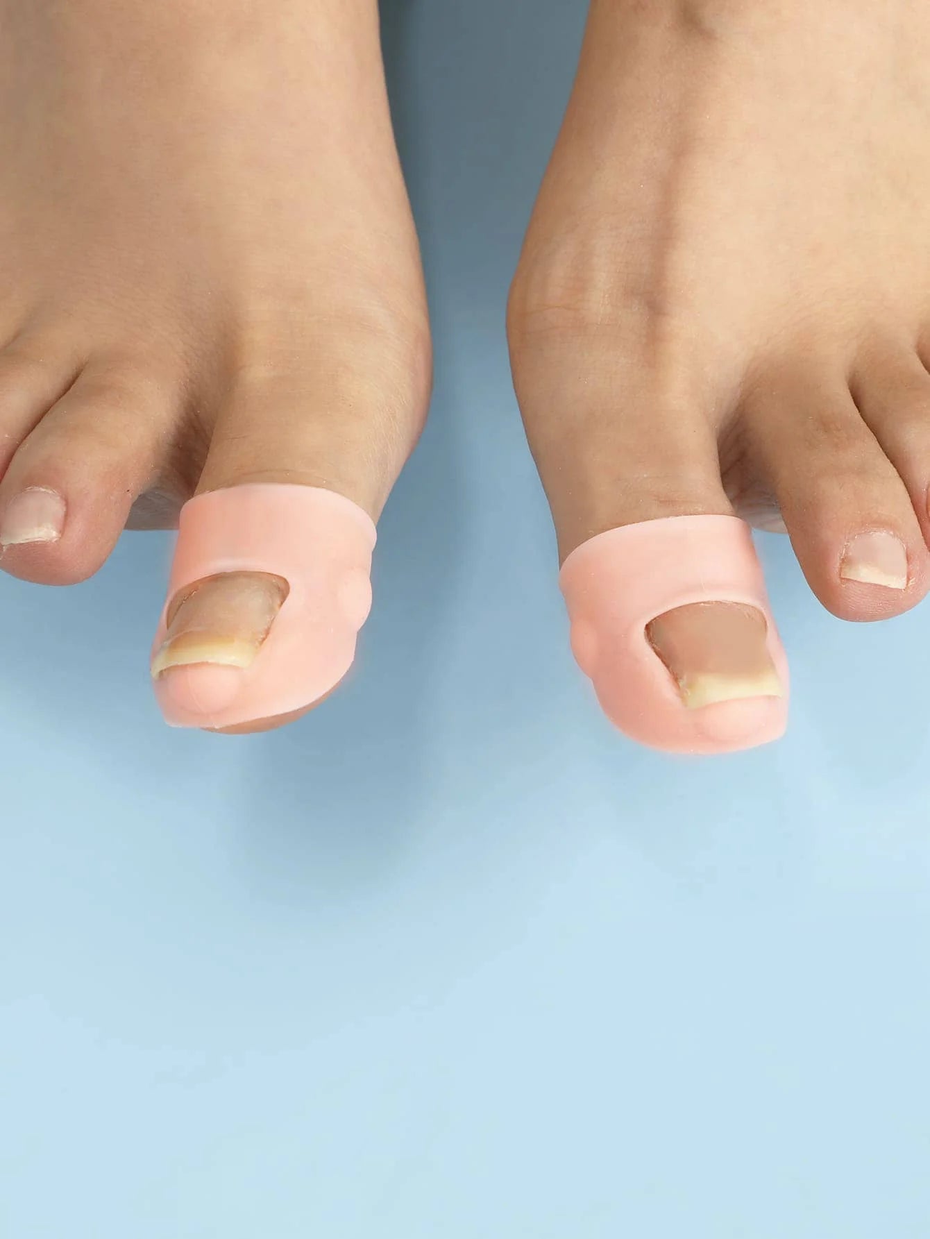 Silicone Ingrown Toenail Protector Cover – 2pcs Nail Guard