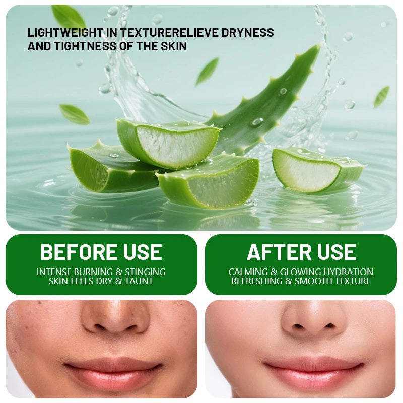 LGRAMER Aloe Vera Face Cream 100g – Moisturizer for Dry Skin