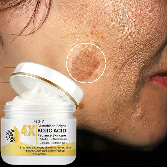 Kojic Acid Face Cream – Brightening & Dark Spot Corrector 60g Brightening Face Cream Oasis Select