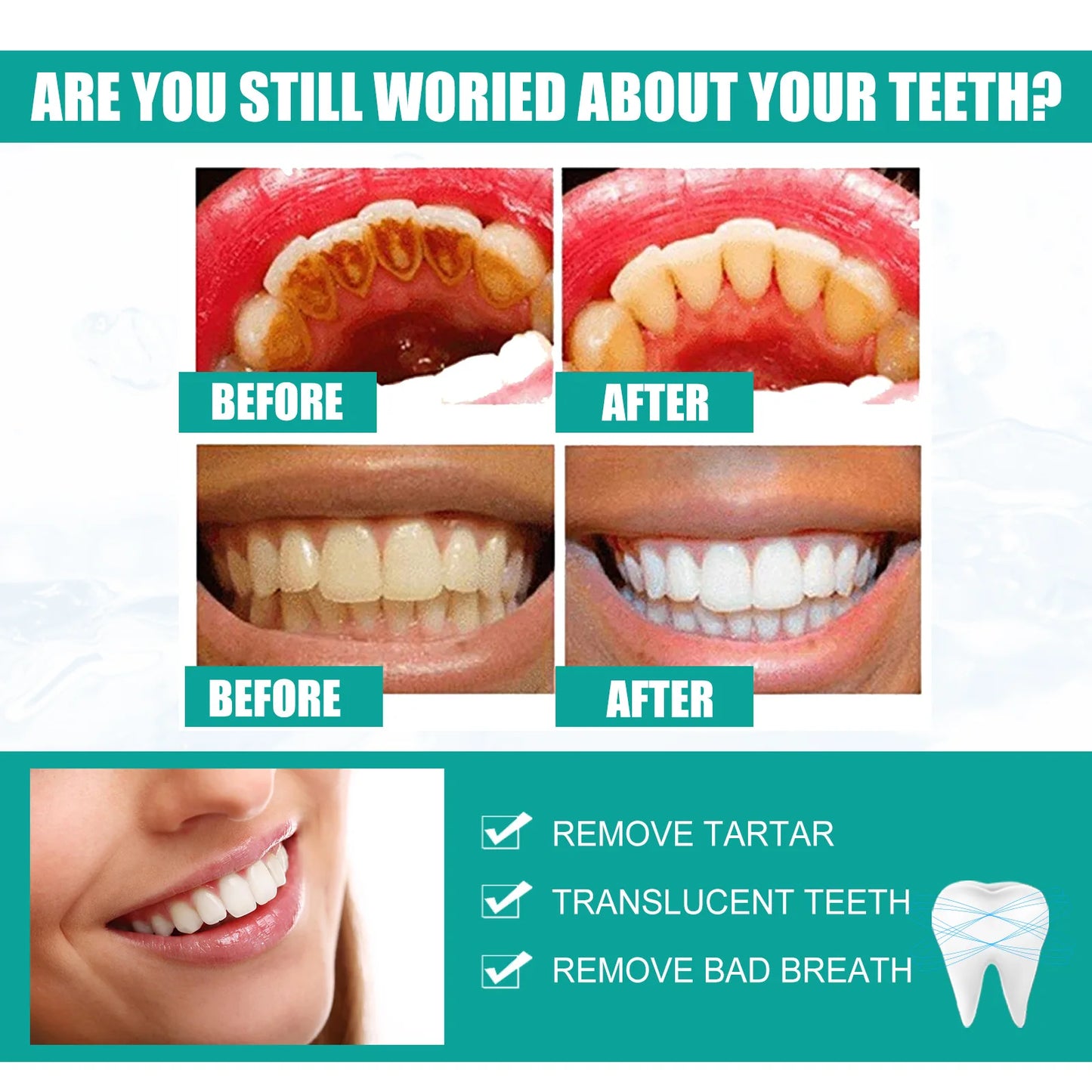 Brightening Teeth Powder – Stain Remover & Breath Freshener