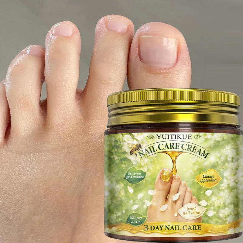 Yuitikue 3 Day Nail Care Cream, 60g Nail Repair Cream to Boost Nail Shine, Improve Nail Condition & Appearance Peaceful Pleasures Health and Wellness