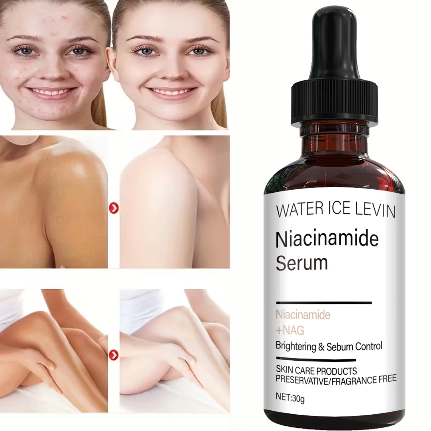 Niacinamide Serum Cream – Bee Venom, Collagen, Oil Control