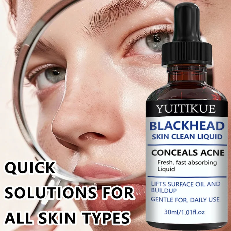 YUITIKUE Blackhead Remover Liquid Gentle Acne Oil Control Deep Cleansing Pore Refining Skin Care Peaceful Pleasures Health and Wellness