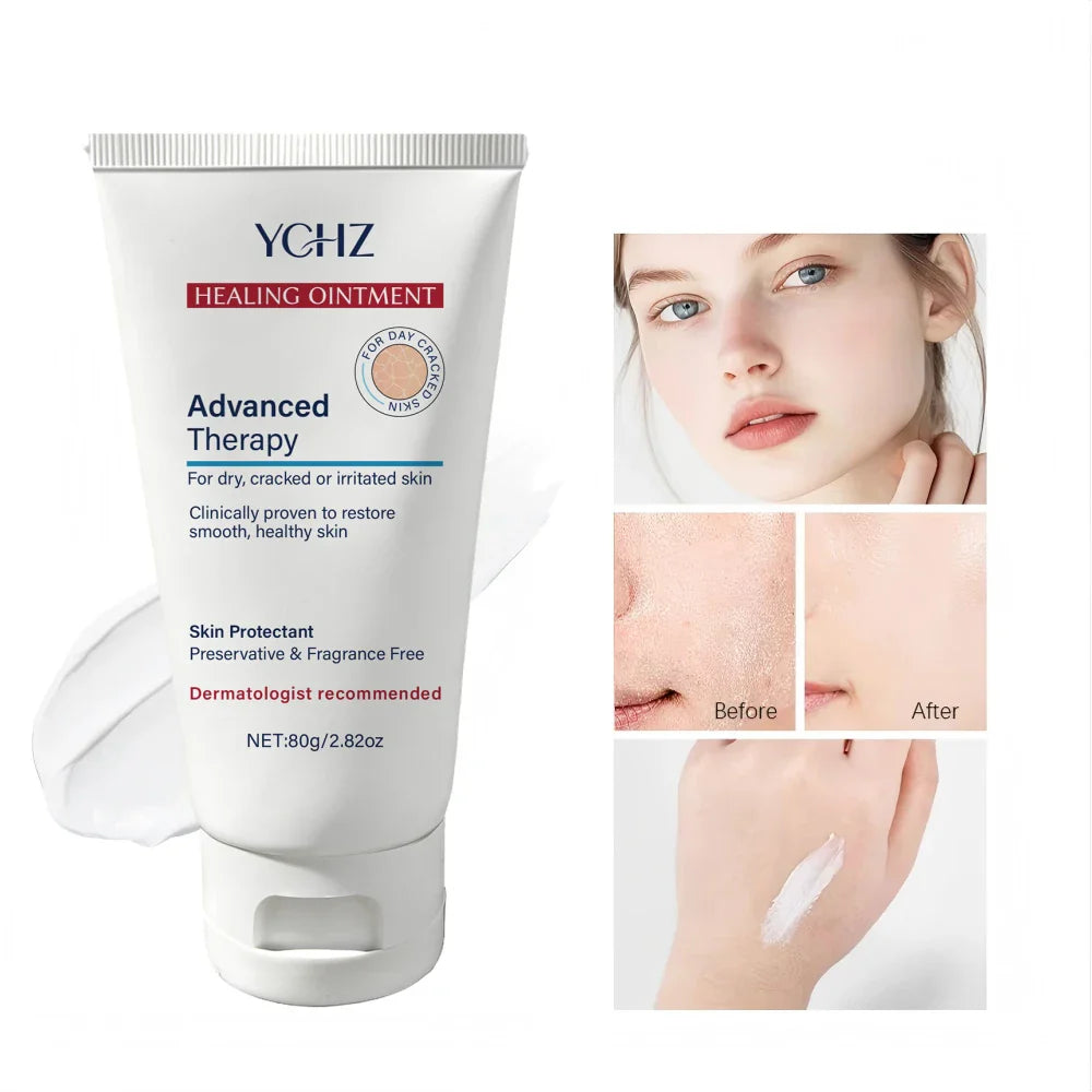 YCHZ Hydrating Body Cream – Shea Butter, Vitamin E & Hyaluronic Acid