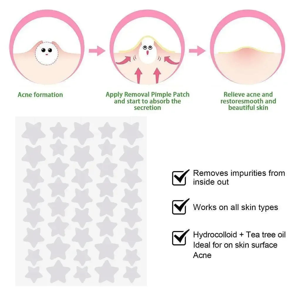 40pcs/120pcs Colorful PE Pimple Patches Cute Star Shaped Pimple Cover Sticker Invisible Pimple Cover Removal Pimple Patch Peaceful Pleasures Health and Wellness