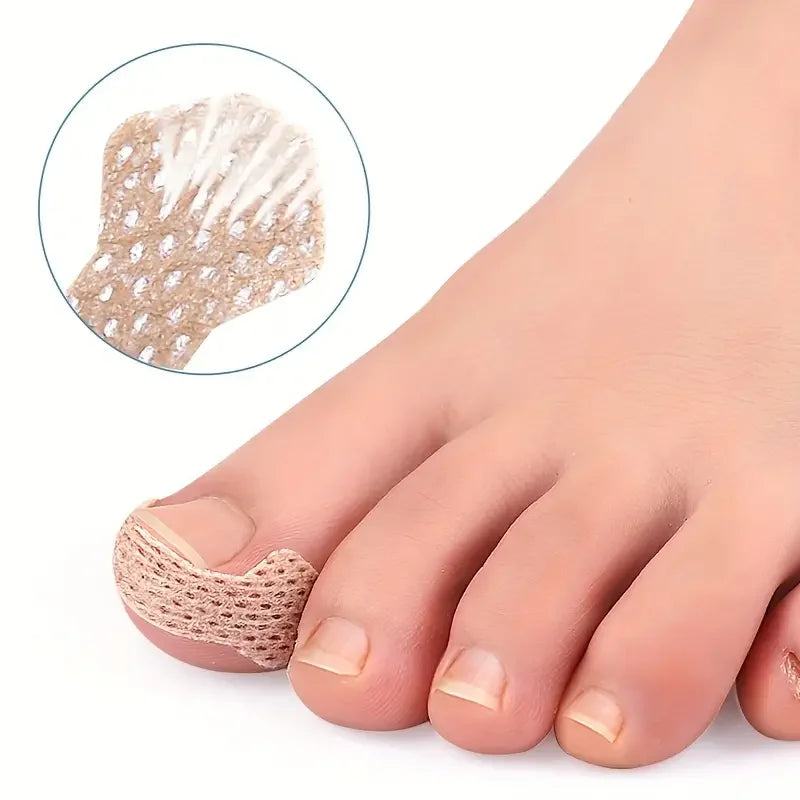0pcs Toe Patch Set Get Relief from Ingrown Toenails & Enhance Nail Care with Orthopedic Support Nail pulling patch orthotics Peaceful Pleasures Health and Wellness