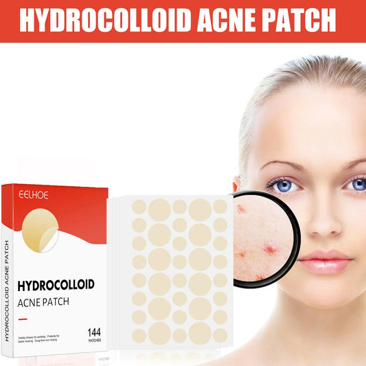 Hydrocolloid Acne Patches 144pc – 2 Sizes, Invisible & Clear Acne Patch Oasis Select