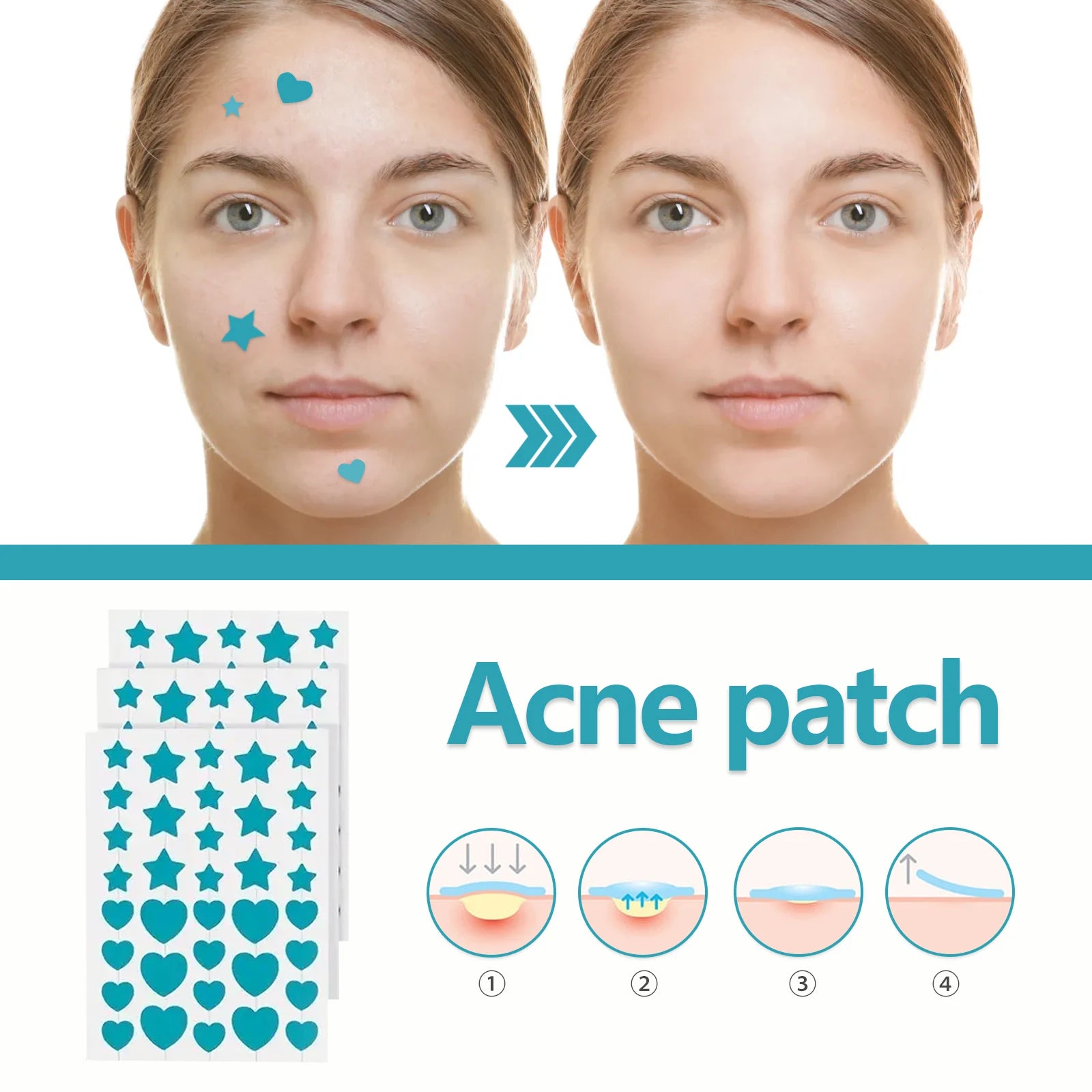 216pcs Hydrocolloid Acne Patch Repair Acne Cleansing Invisible Breathable Waterproof Acne Cleansing Concealer Fade Clean Peaceful Pleasures Health and Wellness