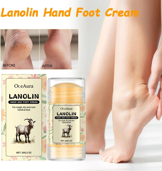 Lanolin Hand Foot Stick For Dry Cracked Rough Skin Gentle Moisturizing Nourishing Anti Crack Preventing Your Feet From Cracking Peaceful Pleasures Health and Wellness