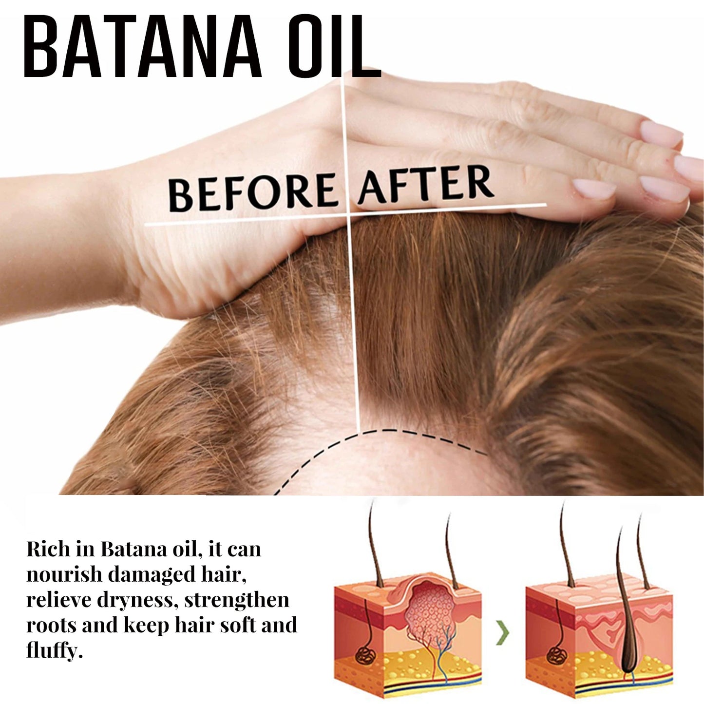 Batana Oil Hair Growth Spray – Anti Hair Loss for Men & Women