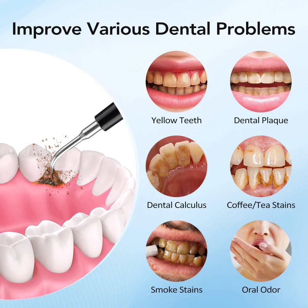 Electric Dental Scaler with Teeth Brush Head Calculus Tartar Remover Vibration Teeth Plaque Cleaner Oral Care Improve Odor Peaceful Pleasures Health and Wellness