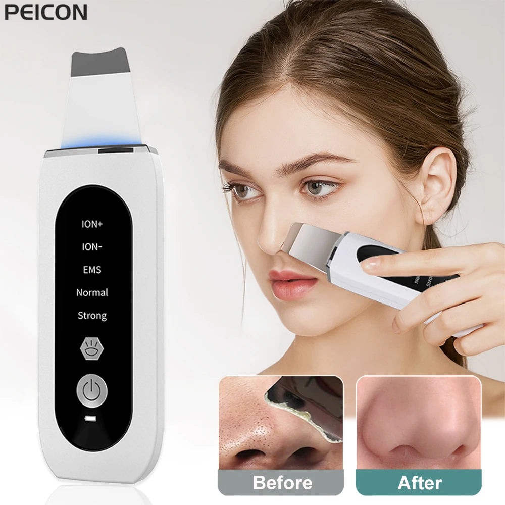 Ultrasonic Skin Scrubber Facial Peeling Face Scrubber Blackhead Remover Ance Pore Deep Facial Cleaning Spatula Facial Cleanser Peaceful Pleasures Health and Wellness