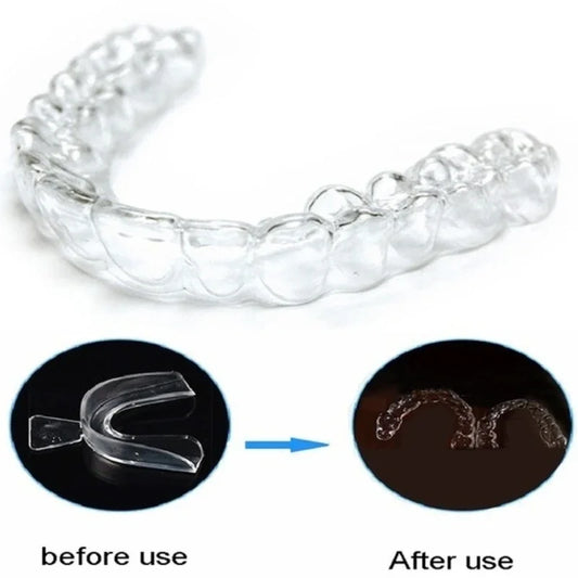 Night Guard for Teeth Grinding & Snoring – 1/2/4 Pack Mouth Tray Night Guard Mouth Tray Peaceful Pleasures Health and Wellness