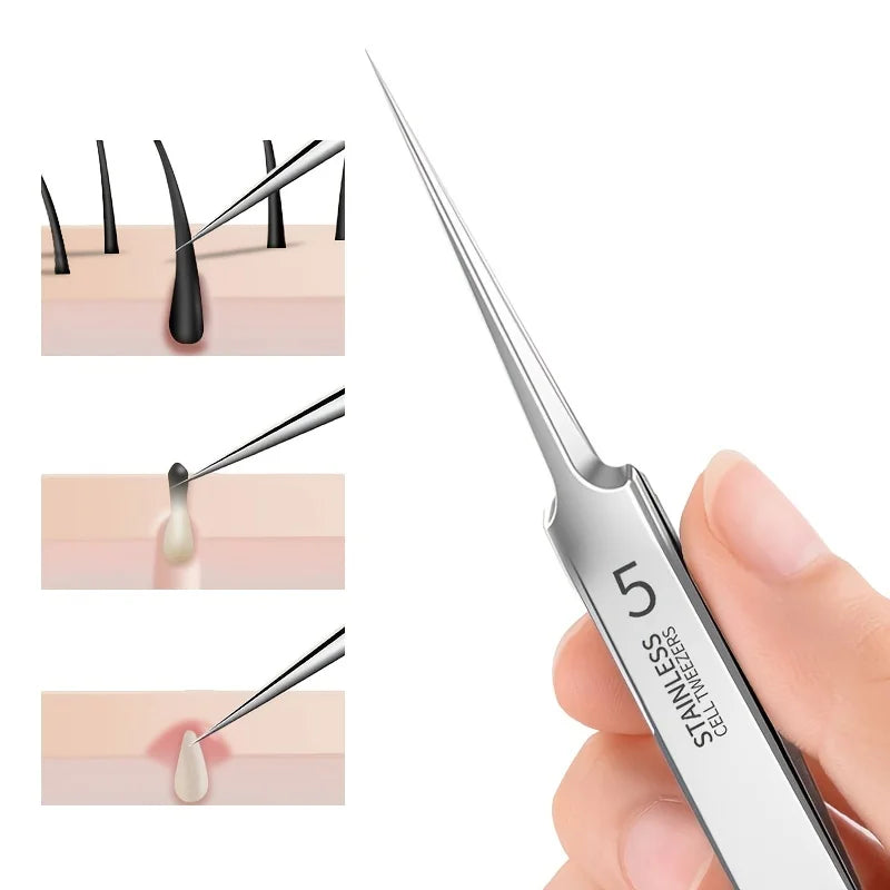 German Ultra-fine No. 5 Cell Pimples Blackhead Clip Tweezers Beauty Salon Special Scraping & Closing Artifact Acne Needle Tools Peaceful Pleasures Health and Wellness