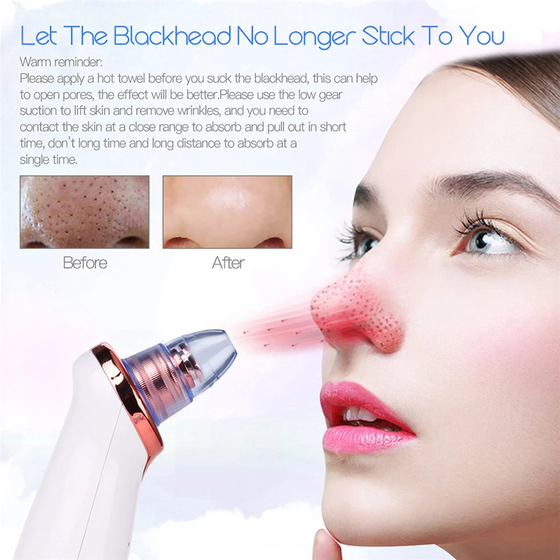 Blackhead Remover Diamond Dermabrasion Nose Vacuum Pore Cleanser Acne Pimple Suction Extractor USB Rechargeable Skin Care Tool Peaceful Pleasures Health and Wellness
