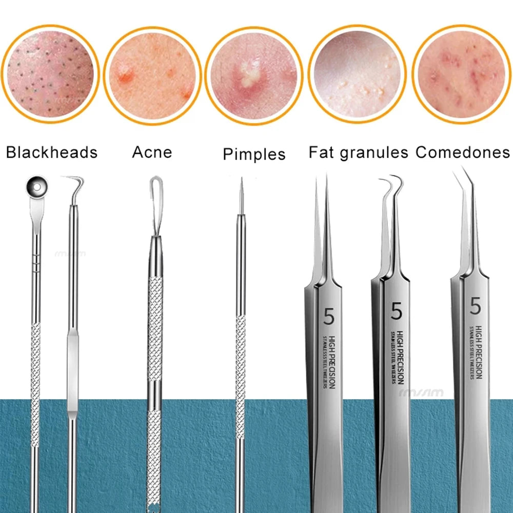Acne Needle Remove Blackhead Comedone Extractor Tools Stainless Steel Facial Skin Care Tool Pimple Blemish Removal Tools Peaceful Pleasures Health and Wellness