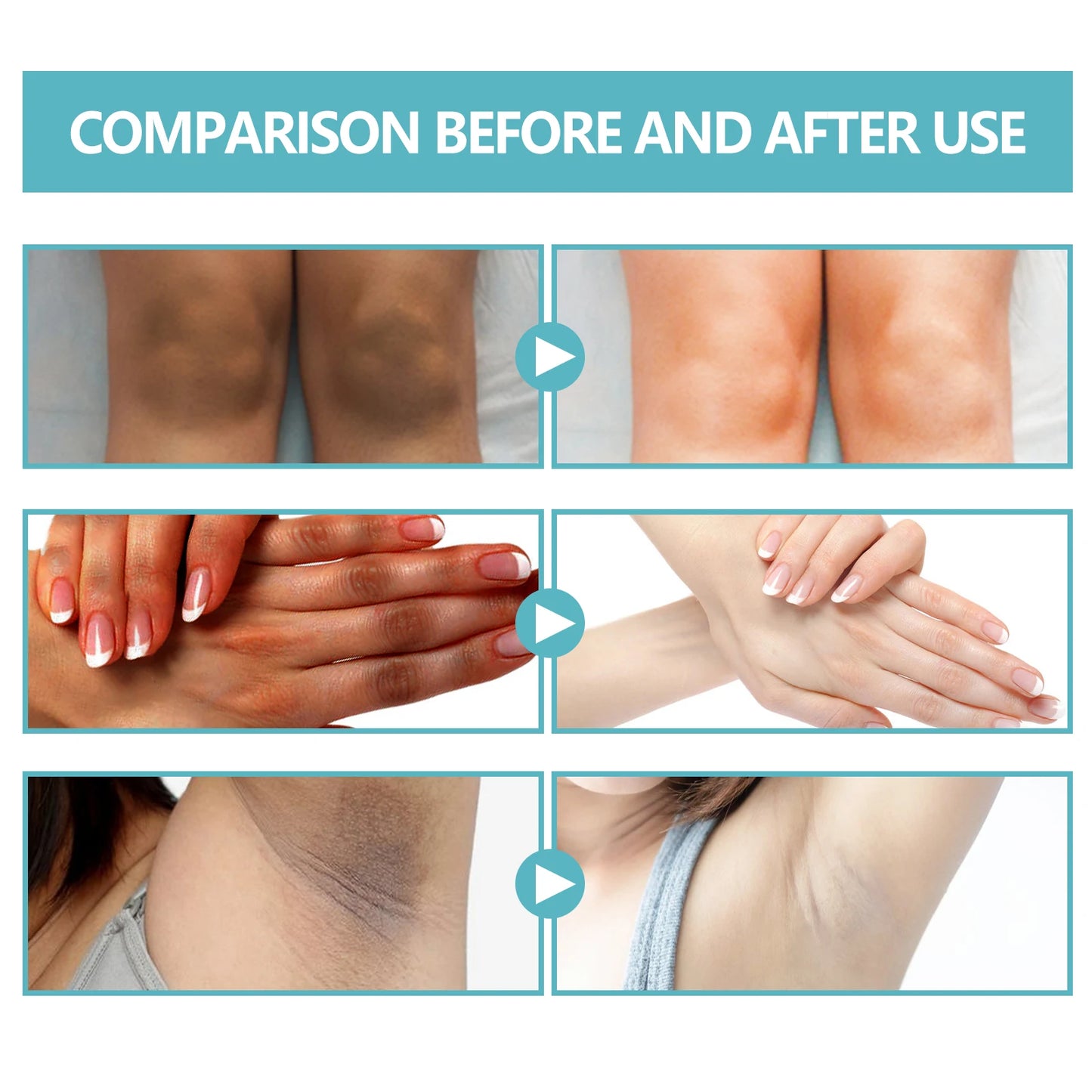 EELHOE Brightening Body Cream for Dark Spots, Neck & Underarms