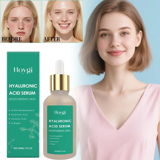 Hoygi Hyaluronic Acid Face Serum – Hydrate & Soothe Skin Hyaluronic Acid Serum Oasis Select