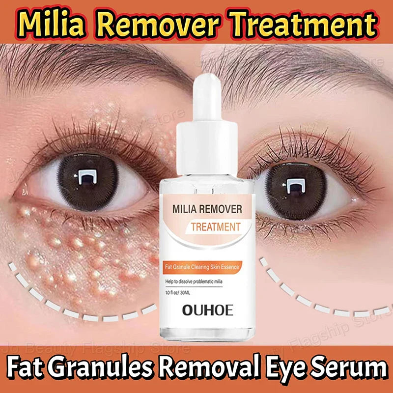 Milia Eye Serum – Firming, Brightening & Moisturizing Skin Care
