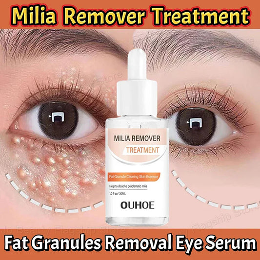 Milia Eye Serum – Firming, Brightening & Moisturizing Skin Care Eye Area Serum Oasis Select Default Title