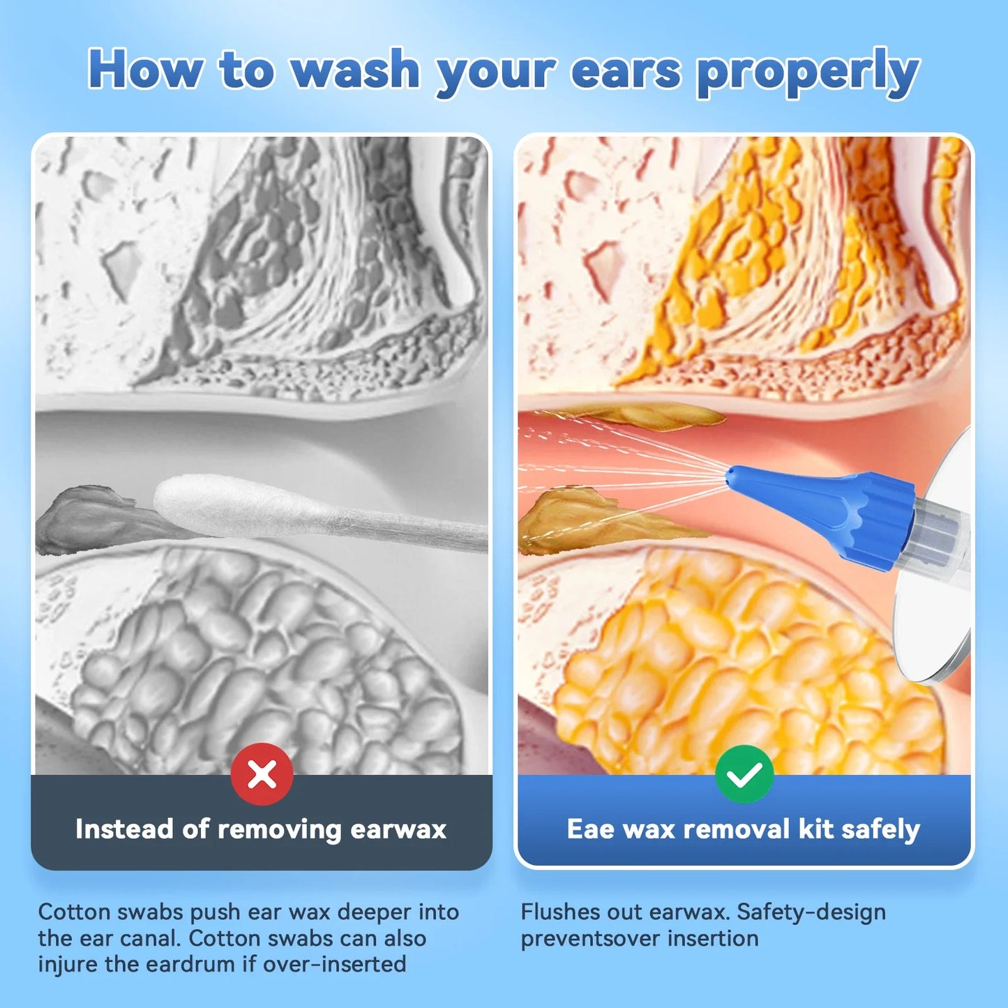 Ergonomic Ear Wax Removal Kit | Silicone Tips & Water Tank