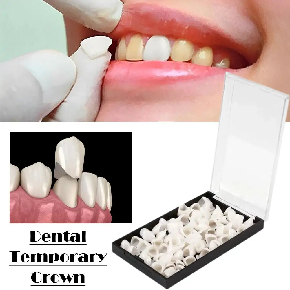 Temporary Dental Crowns | Anterior & Posterior Teeth Set Temporary Dental Crowns Peaceful Pleasures Health and Wellness