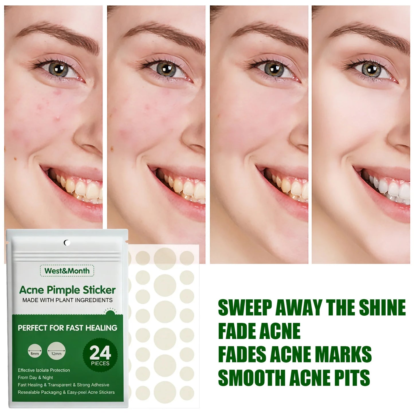 24PCS Hydrocolloid Acne Patches – Salicylic Acid & Glycerin